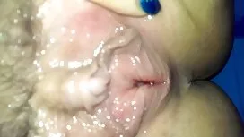 外科医生强迫患者麻醉，这是真的！